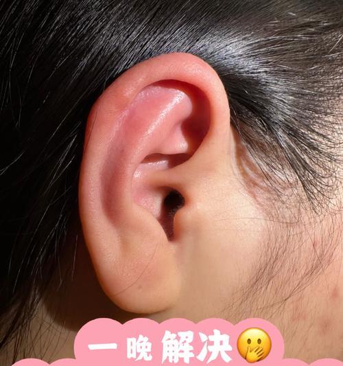 魔兽世界角色耳朵痒了怎么处理？有哪些解决方法？