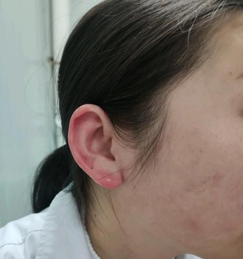 魔兽世界角色耳朵痒了怎么处理？有哪些解决方法？